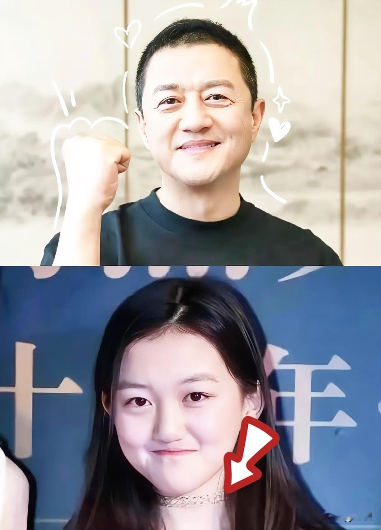 我忍不住问当医生的大哥：“唇腭裂看着就是个小手术，李亚鹏至于投入这么多钱和精