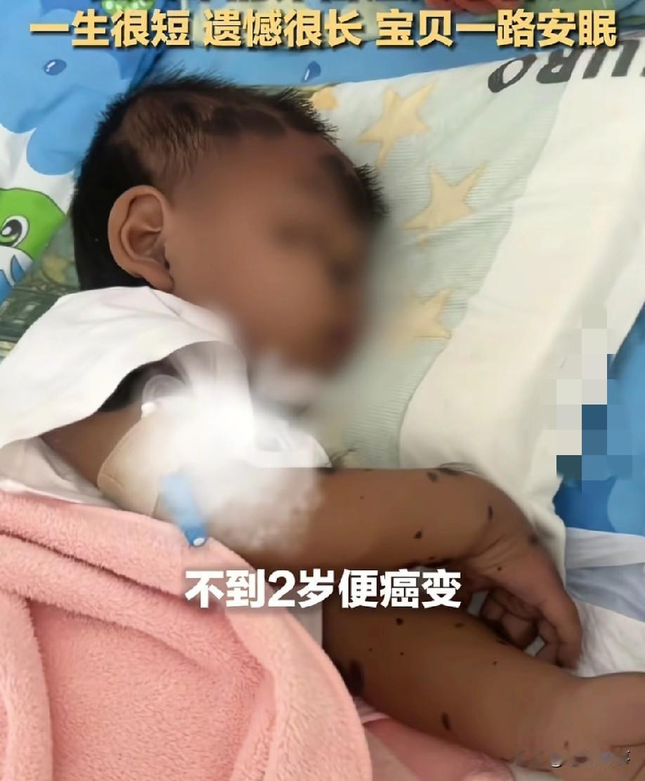 河南商丘，备受关注的"兽皮痣"患儿小乐宝离世了，年仅不到两岁。母亲发布的讣告看哭
