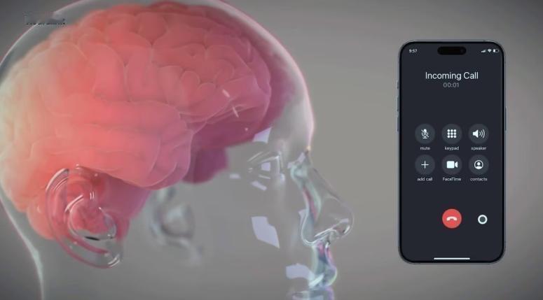 马斯克的脑机接口都有啥功能？装上一个芯片之后。马斯克Neuralink的N1