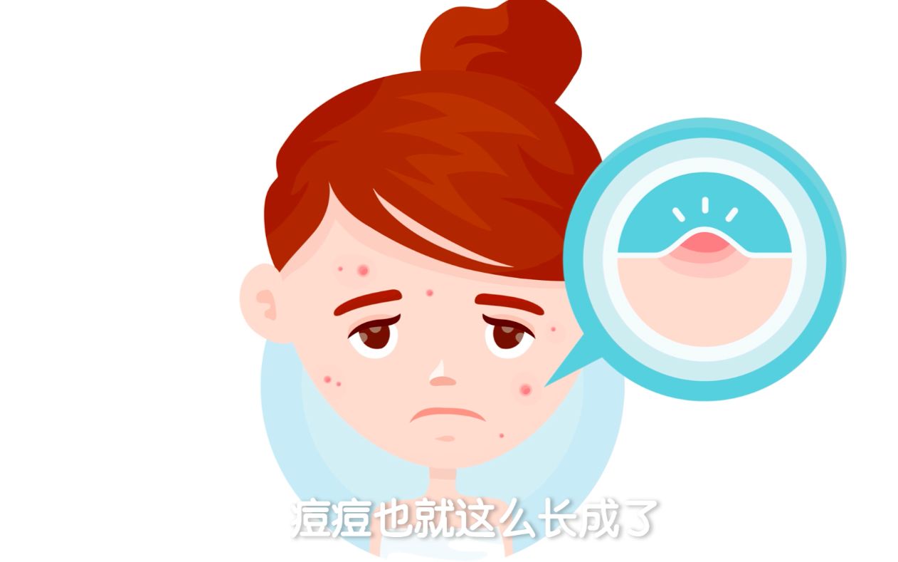 为什么痘痘一直顽固不消退?
