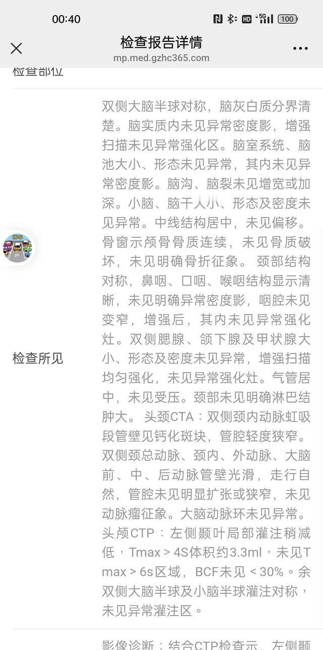 终于我也倒下了,医生说是急性脑梗,可以打溶栓药3600多,过了时间再打就没用