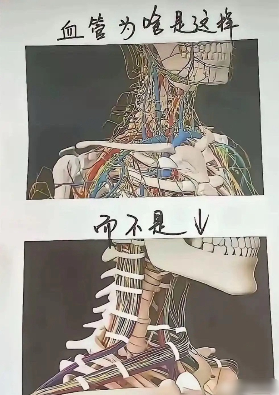 血管为什么是这样，而不是