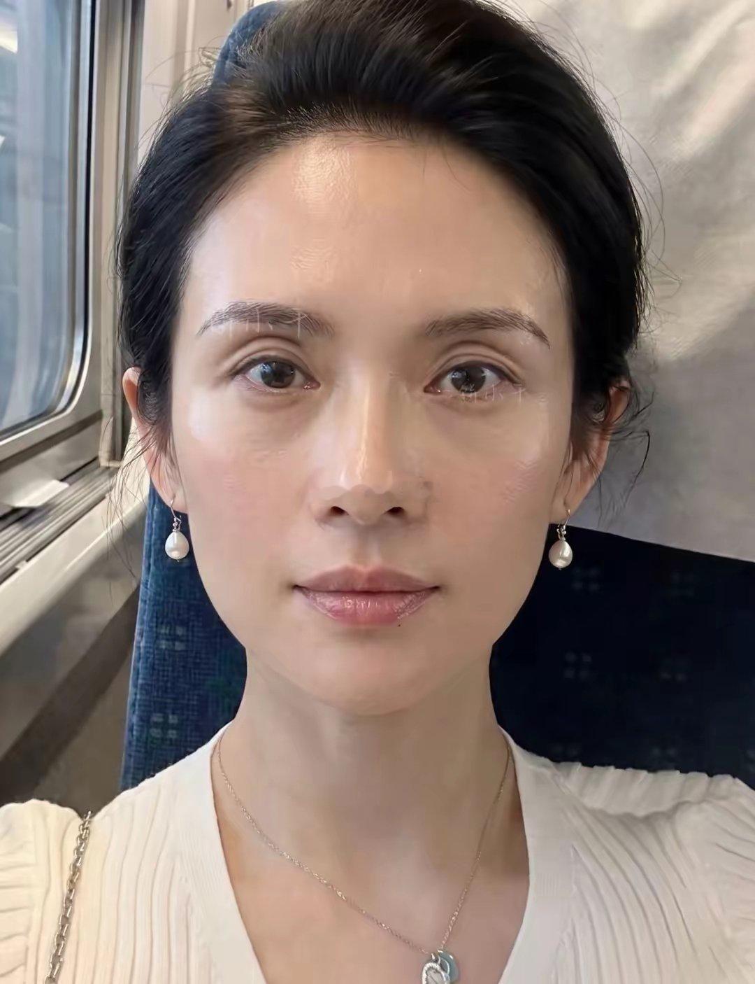 40了又折腾一次，老公说有点像他白月光