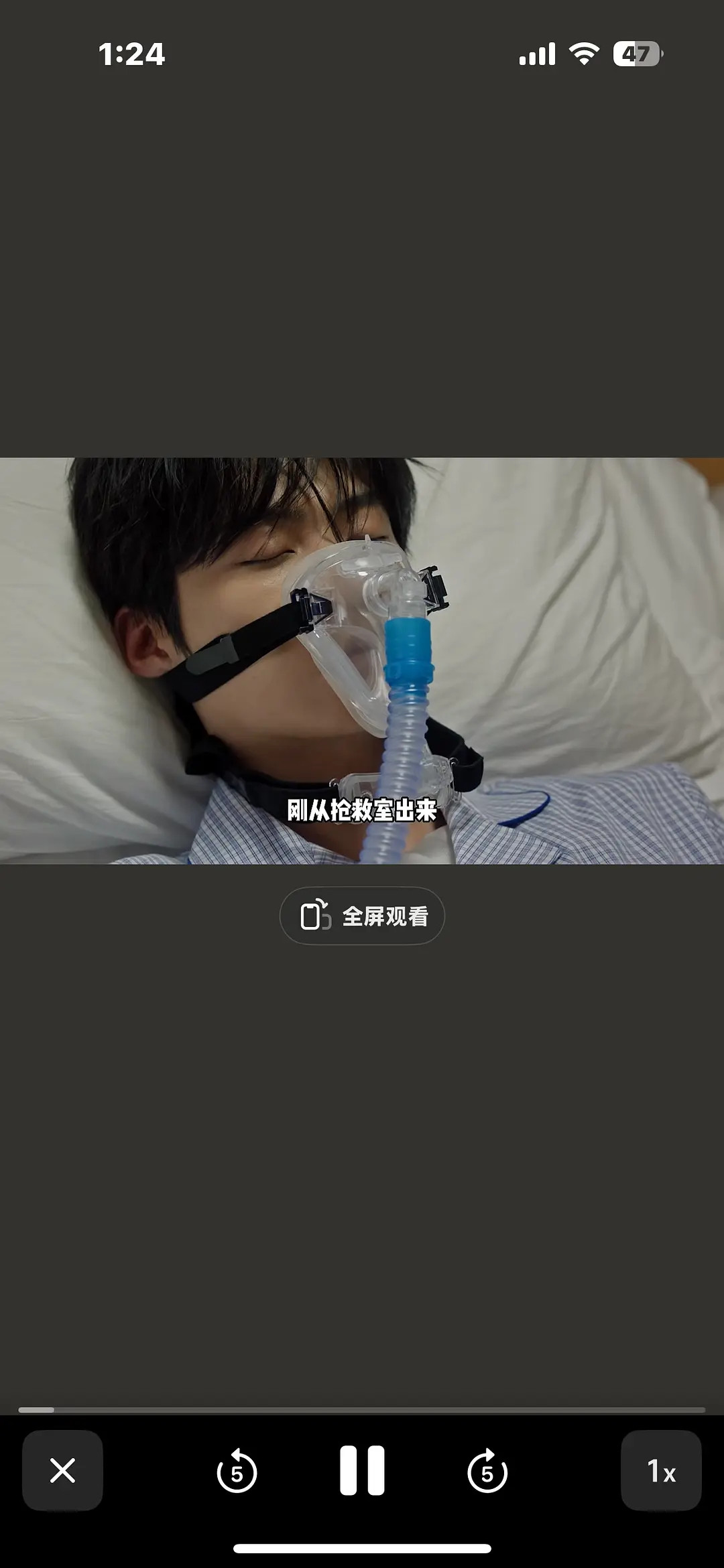 炽夏的男主氧气罩是不是反了…这样演的时候不会不舒服吗？感觉剧组就是个巨大的草台班