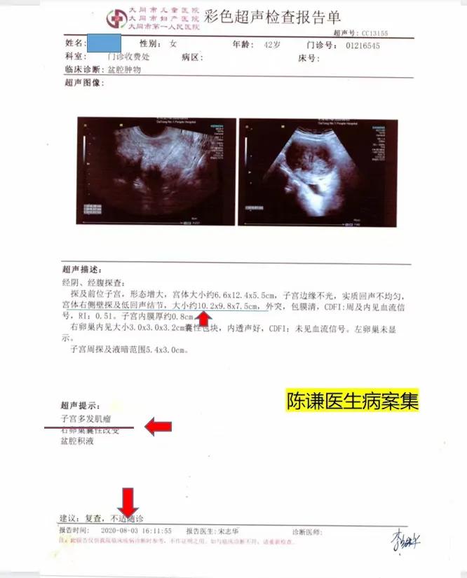 很多患者选择海扶刀治疗时，比较担心的就是没有伤口，肌瘤如何吸收的问题。这是我们