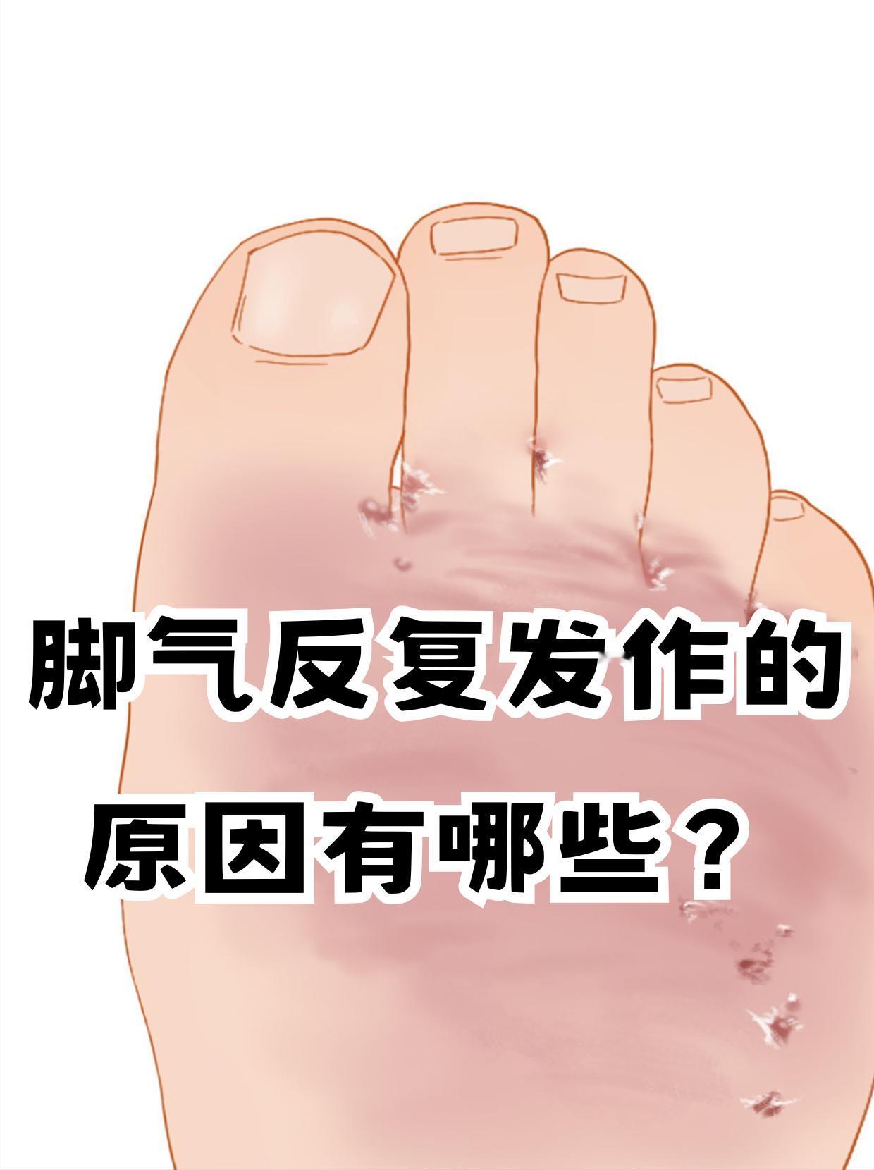 为什么脚气总是反反复复好不了？对于脚气很多人不陌生，这个问题总是反