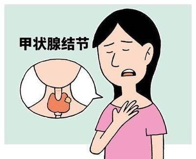 甲状腺结节，没有这5种表现，把心放在肚子里一般情况下，大部分甲状腺结节不会变成