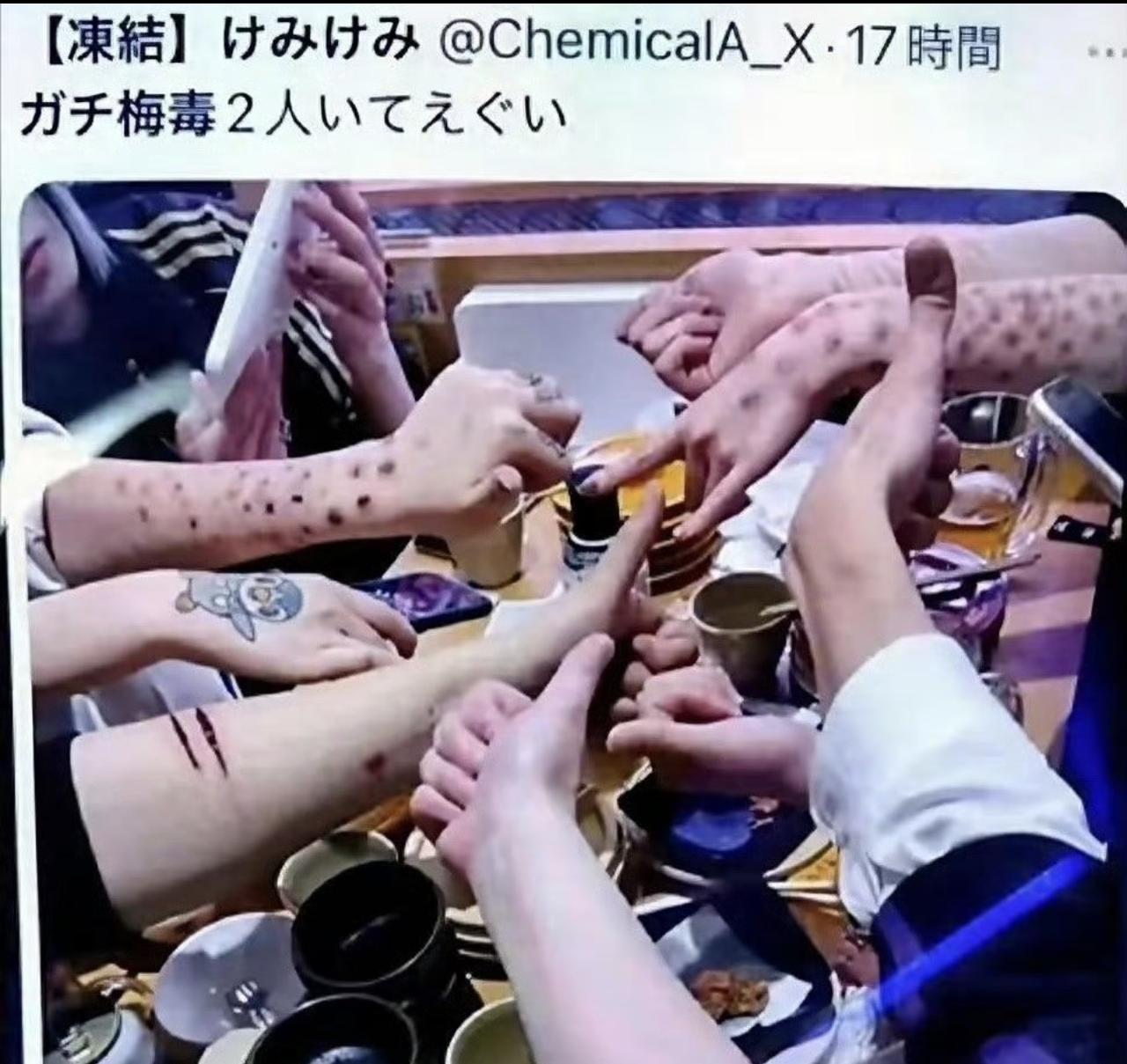 日本怎么回事儿，现在年轻人得梅毒数量飙升不说，居然还不以为耻，反以为荣！居然