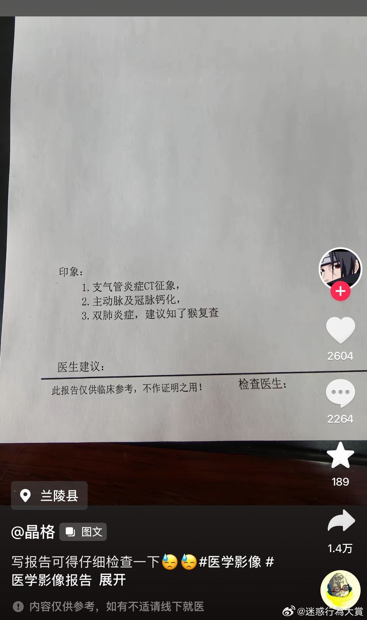 大蜘蛛顺便哼唱
