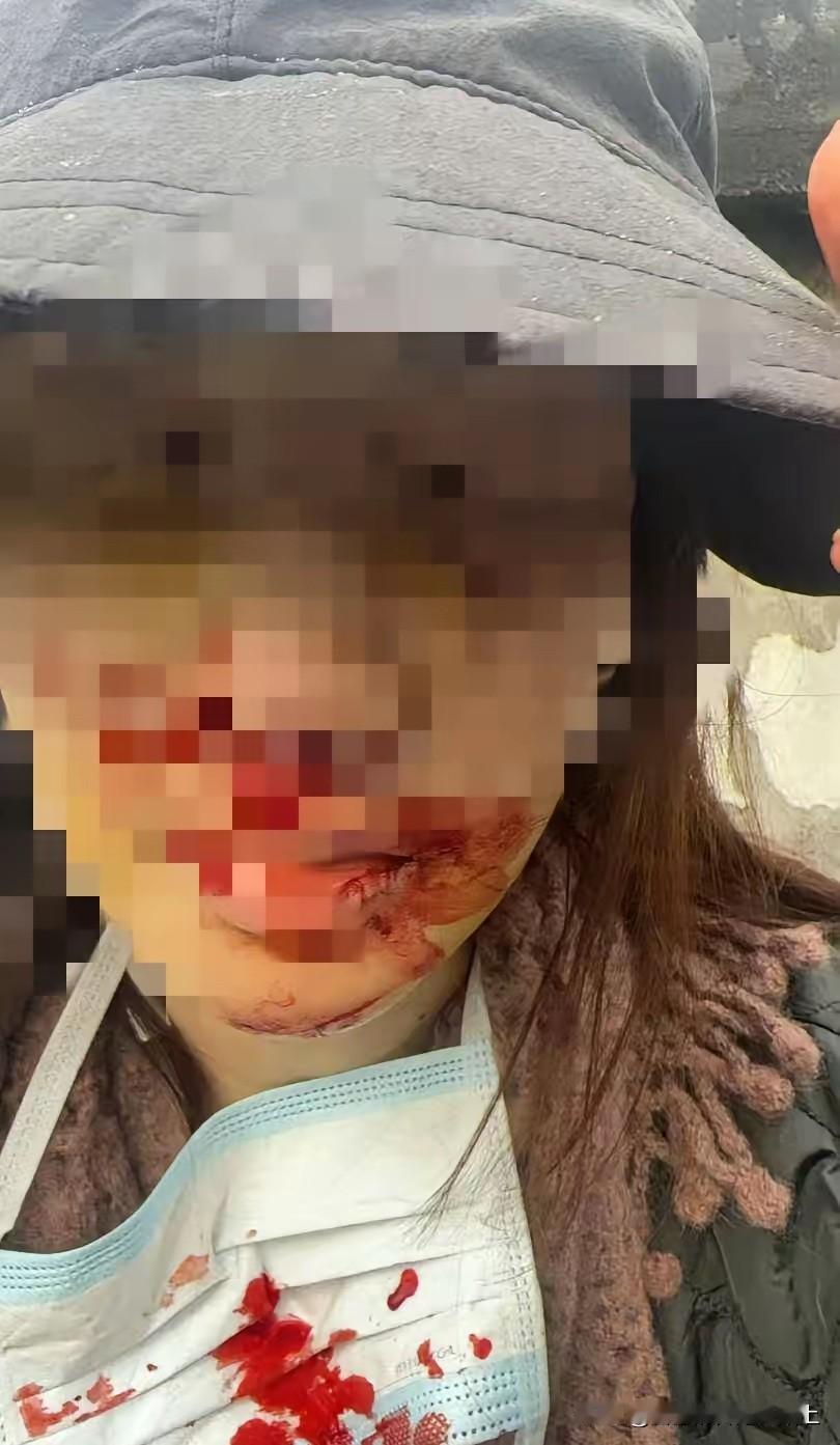 狗仔质疑金晨的警情通报并提出诉求，要求警方重新全面调查，准确认定各方责任再发布警