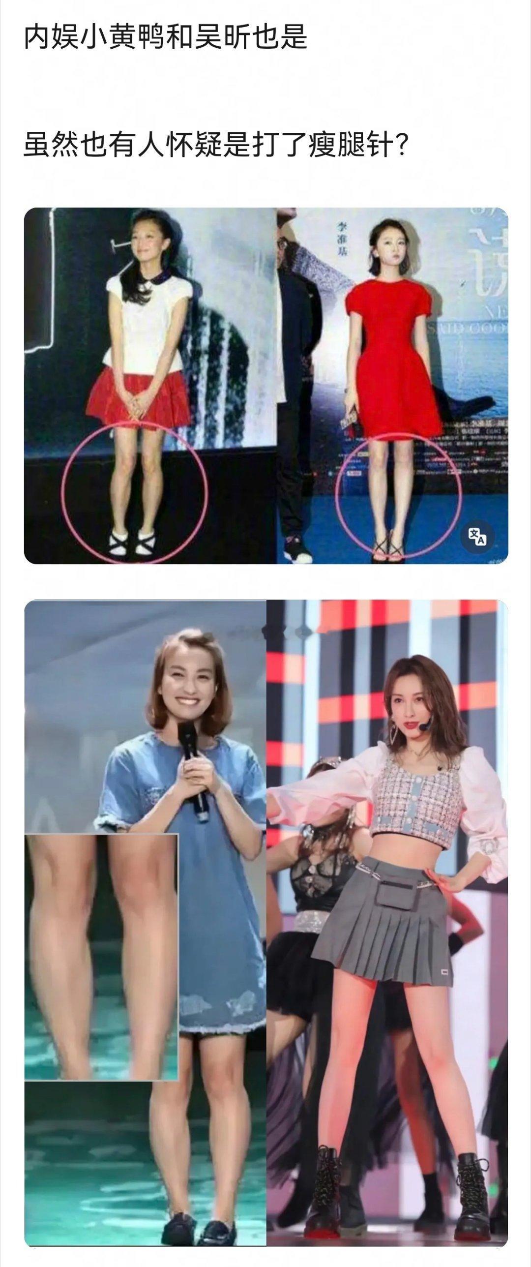 腿型不好到腿变直的明星～