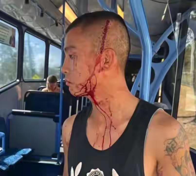 中国拳王在澳遭袭击！当场头破血流，妻子被扯头发拽下公交…已有严重心理创伤，警方起