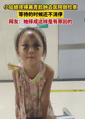 “是应该心疼她呢，还是该笑她呢？”浙江一名小女孩因为摔得鼻青脸肿去医院做检查。由