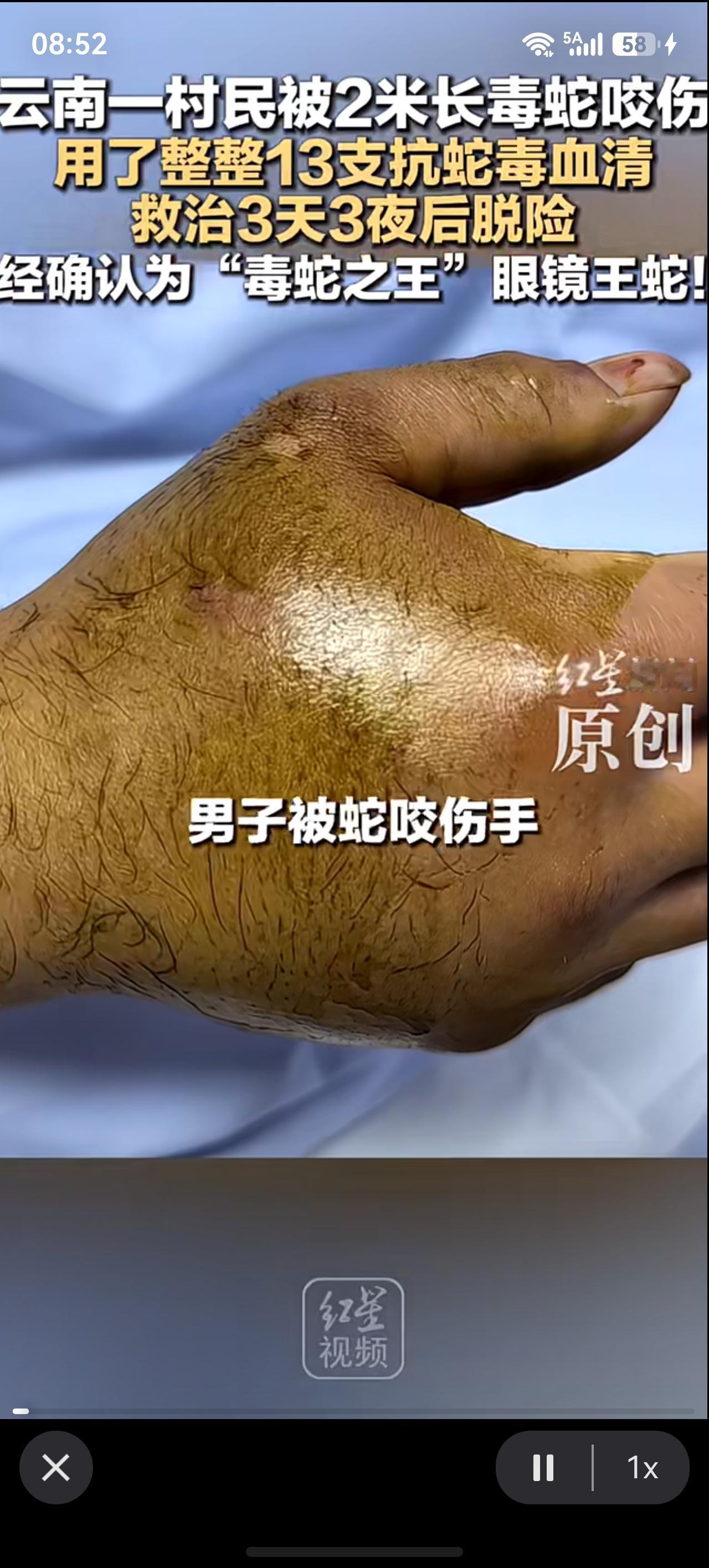 眼镜王蛇是我国二级保护动物，但是你被毒蛇咬伤攻击时，造成毒蛇死亡，依法不追究责任