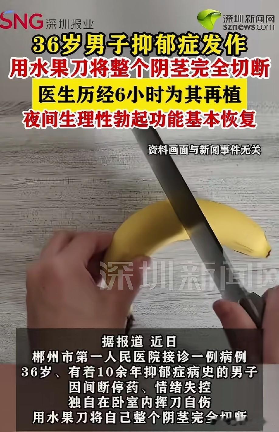 这都能接得回去？医术高超啊！