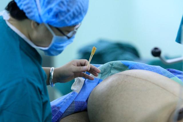 一位母亲在医院生三胞胎女婴, 宝宝剖腹产出生的一幕让人傻眼了!