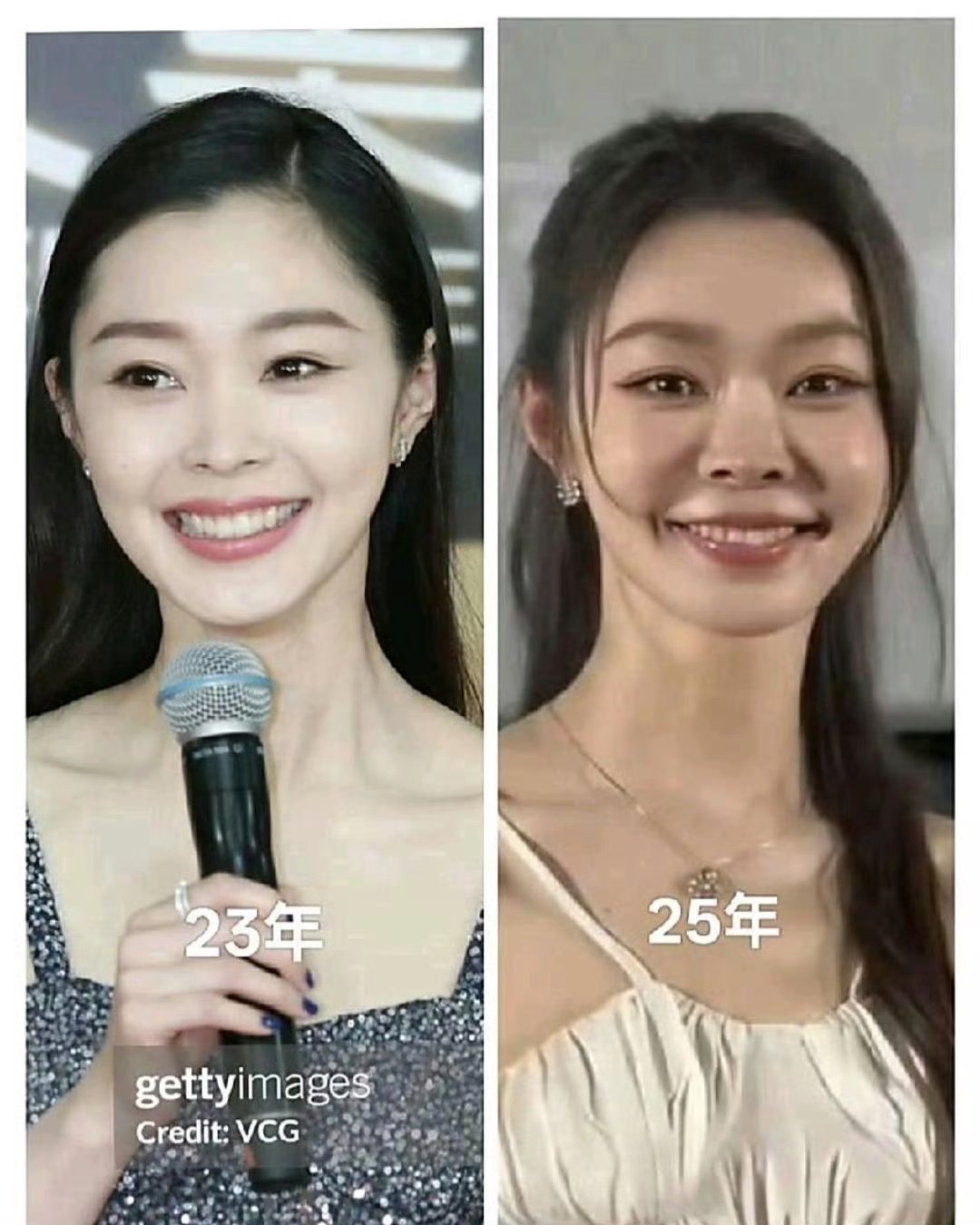 表妹在美容院上班，我问她宋轶到底有没有整容。我看了宋轶的对比照片，表妹沉默了好一会儿才说:“先不说她