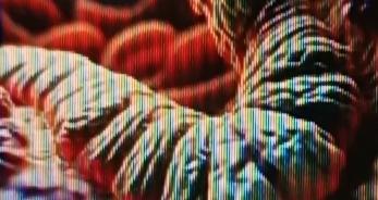 得了幽门螺旋杆菌，饮食上有些东西能帮大忙。西兰花就很不错，它含有的异硫氰酸酯能抑