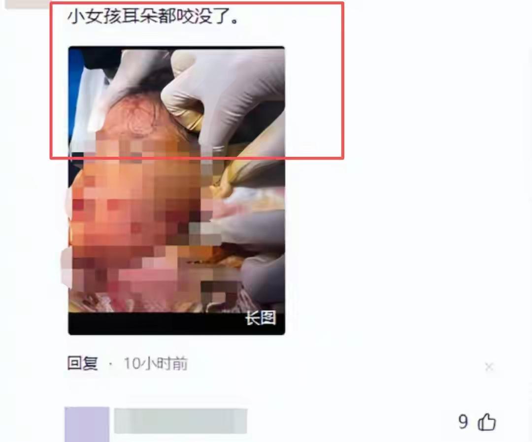 被狗咬伤后续：知情人曝猛料，刑拘只是开胃菜，女童情况令人担忧。四川这起恶犬伤人