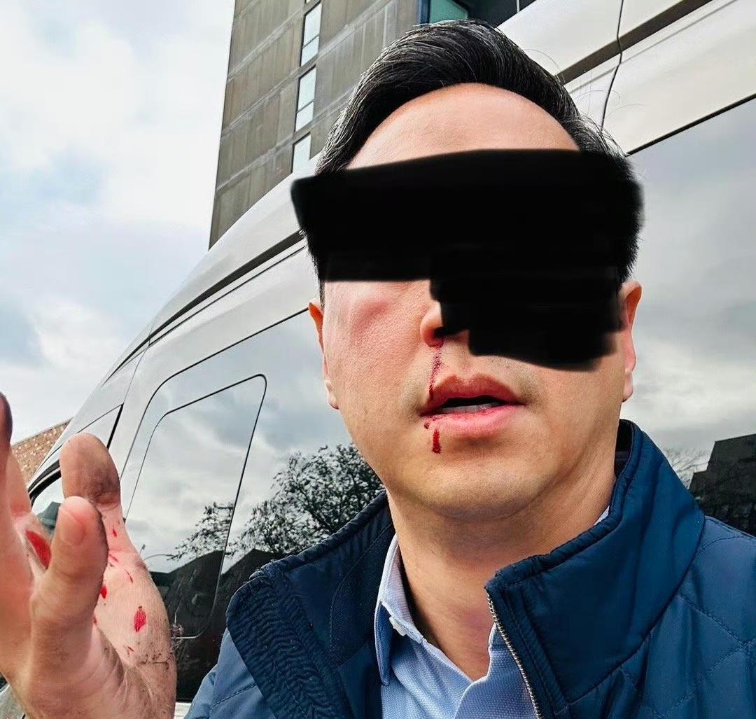 一名45岁的华人在纽约地铁BoweryStation站台被一名黑人无端重拳袭击