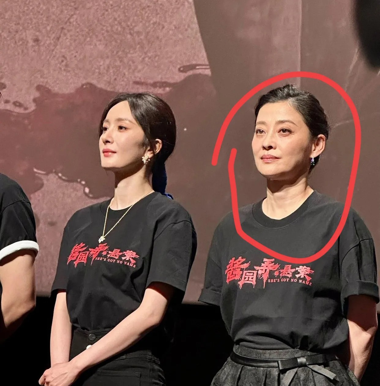 天呐！她怎么老成这样了？她不是才49岁吗？怎么看着跟六十多岁一样，而且看起来有