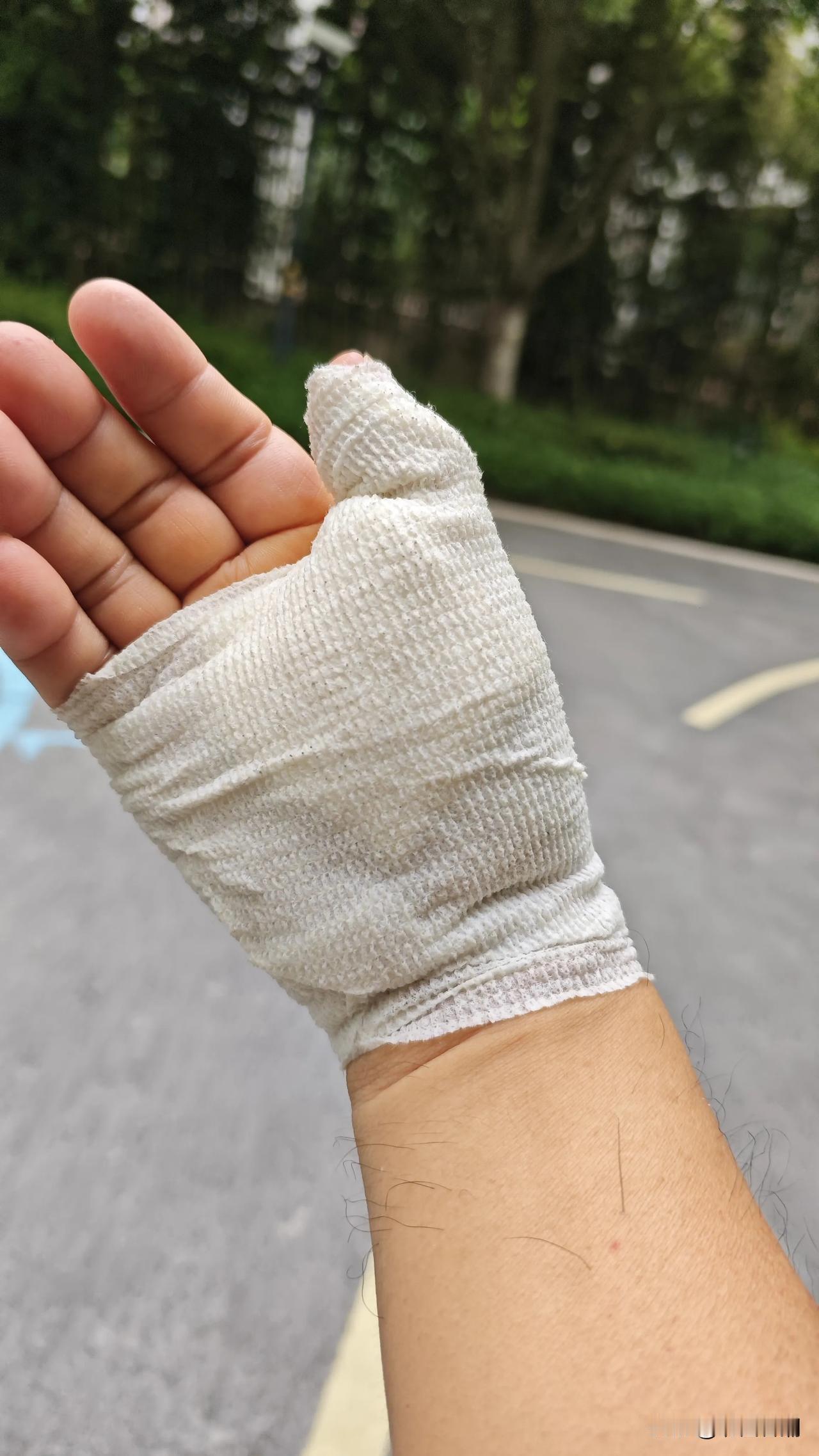 我感觉我今天创造了一个历史，一个医学上的新病种，在我身上真实地发生了，因为连医生