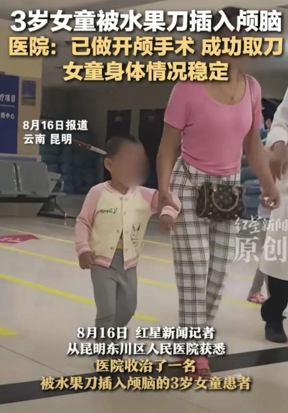 三岁女童头上插刀，医生:刀子是固定住了，她妈妈说她拔不下来才来医院的“自己拔