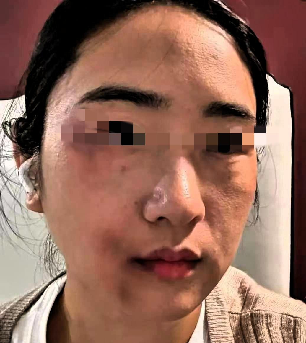 孕36周的准妈妈被丈夫一脚踹在腰侧，没哭没闹，转头去医院开了病历直奔派出所。她说