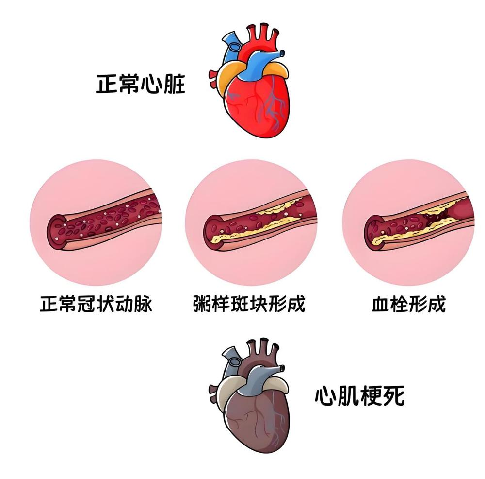7月16日，是一个此生永远铭记的日子。现在回头看真的一身冷汗，给所有三四十岁