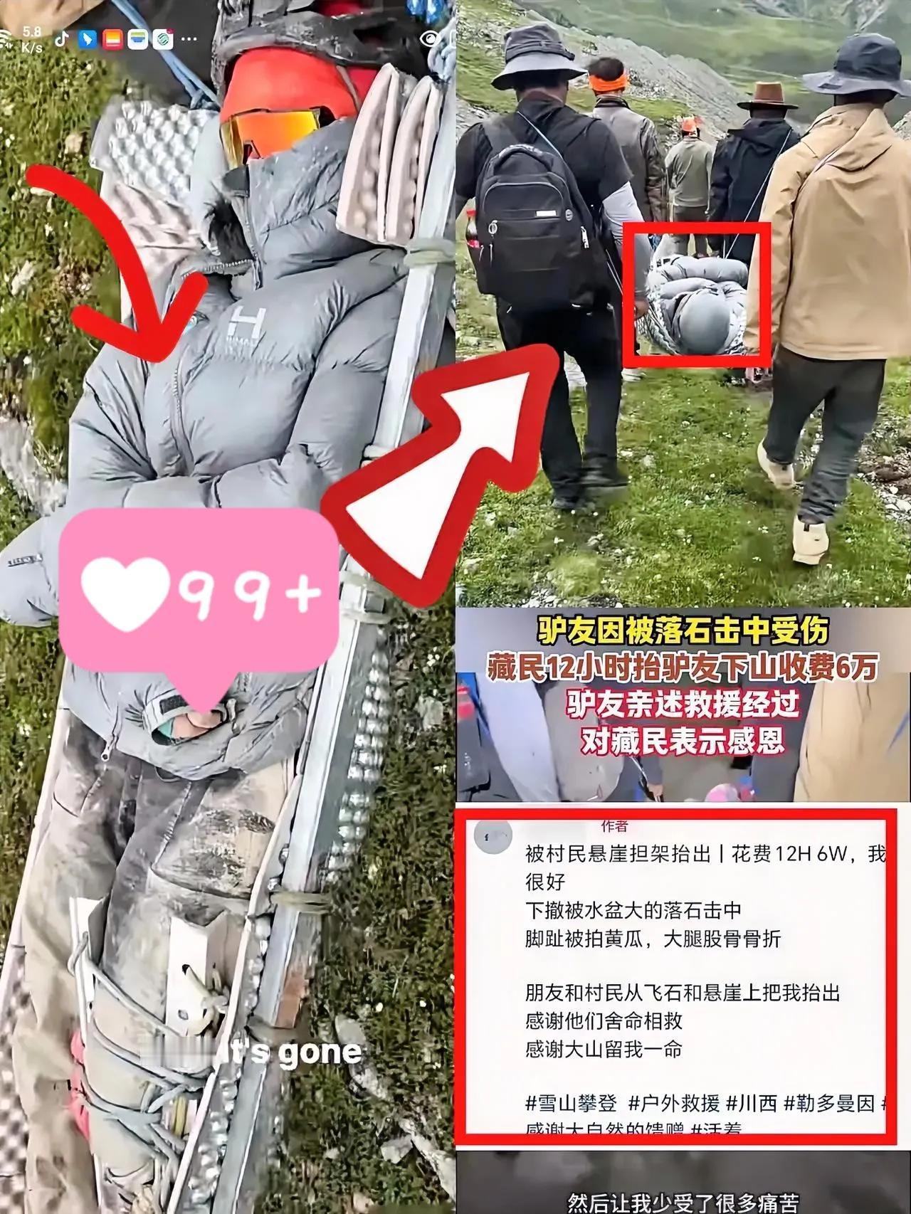 终于弄明白了，骨折女孩为什么同意6万块下山了，不是讹钱，而是她真的没第二条
