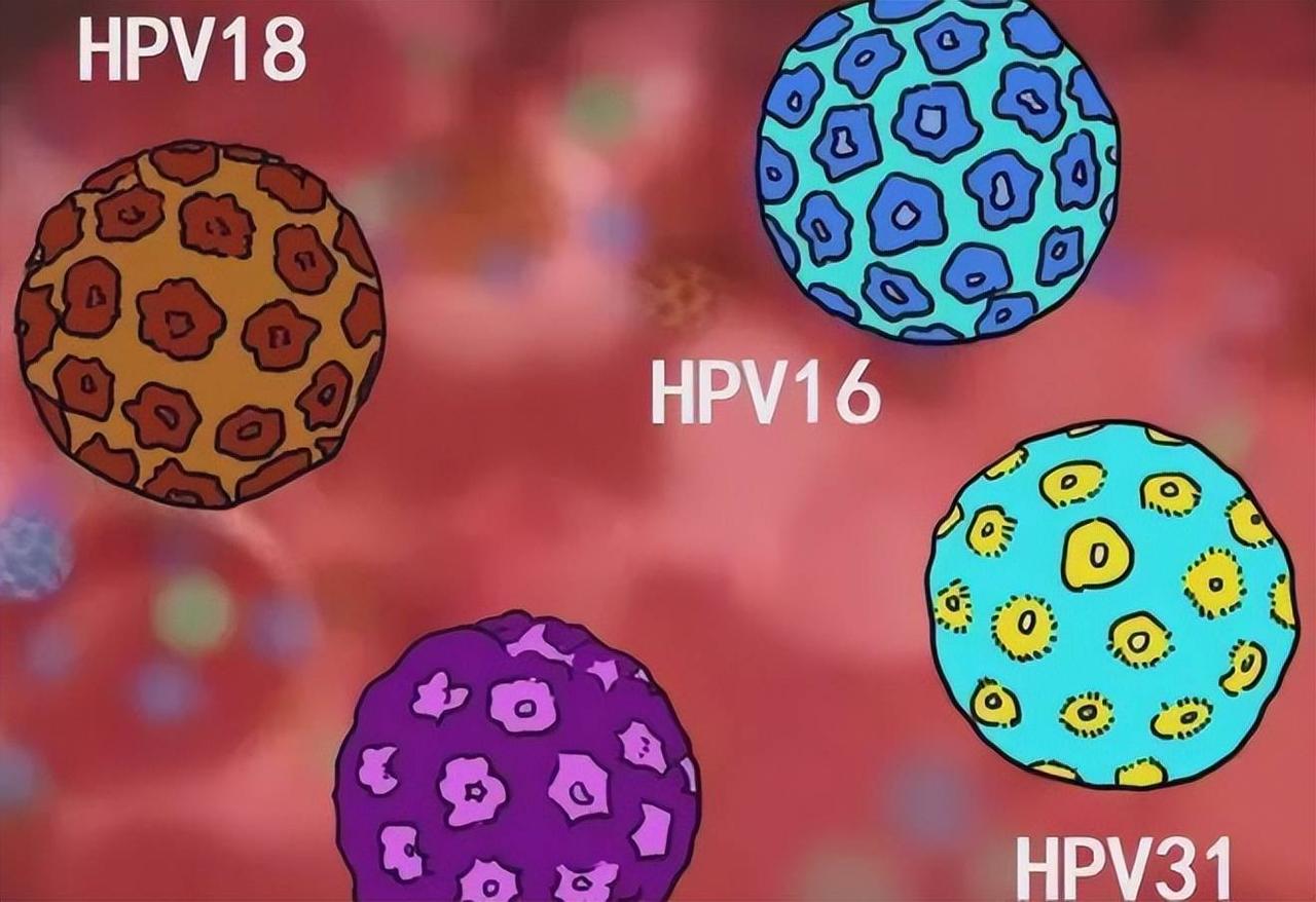 感染了HPV，这2种型号很难治！希望你没有遇到感染HPV后，很多人最常问的一