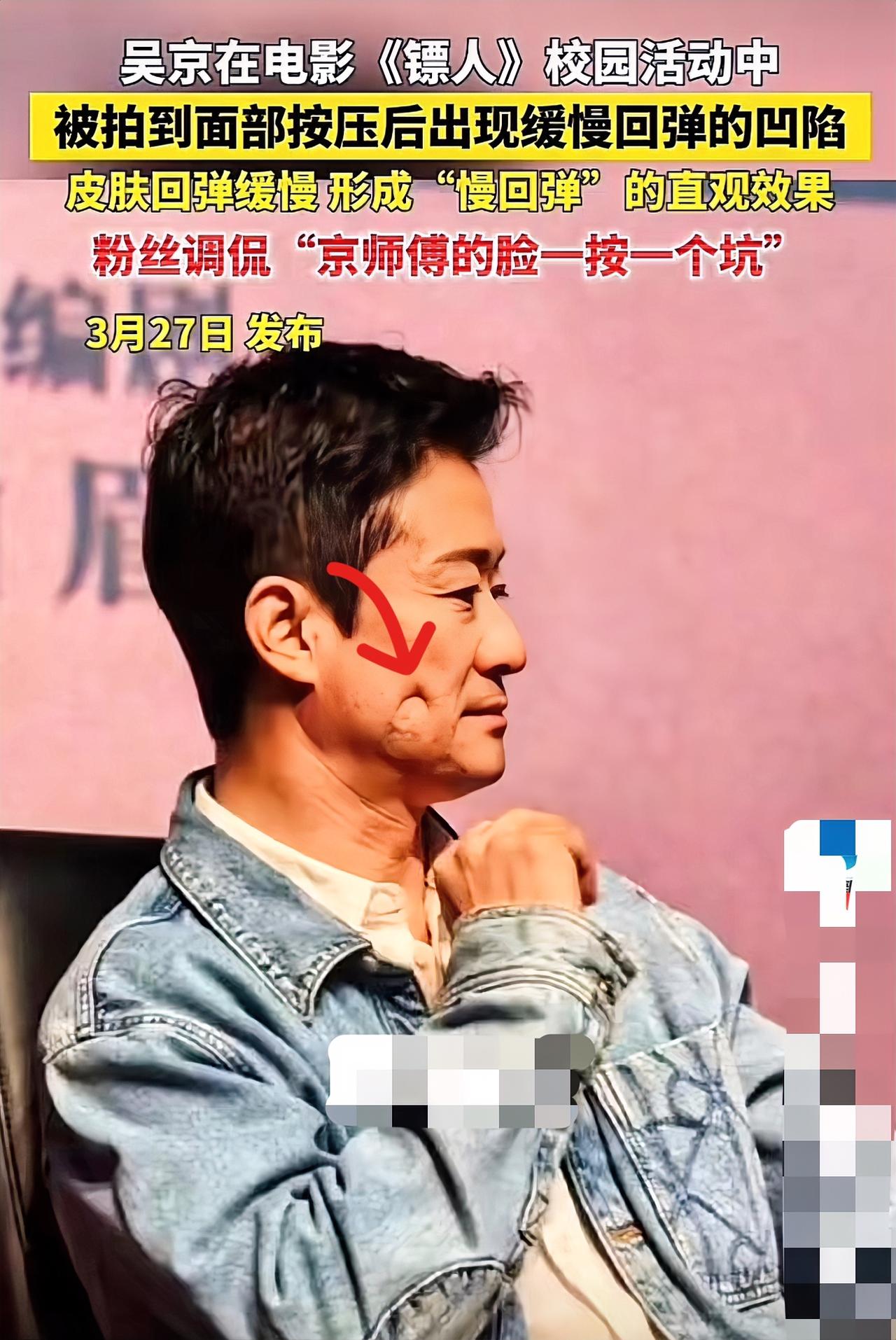 吴京在《镖人》校园活动上“脸一按一个坑”直接出圈了，迅速登上热搜。当时他戳脸倾听