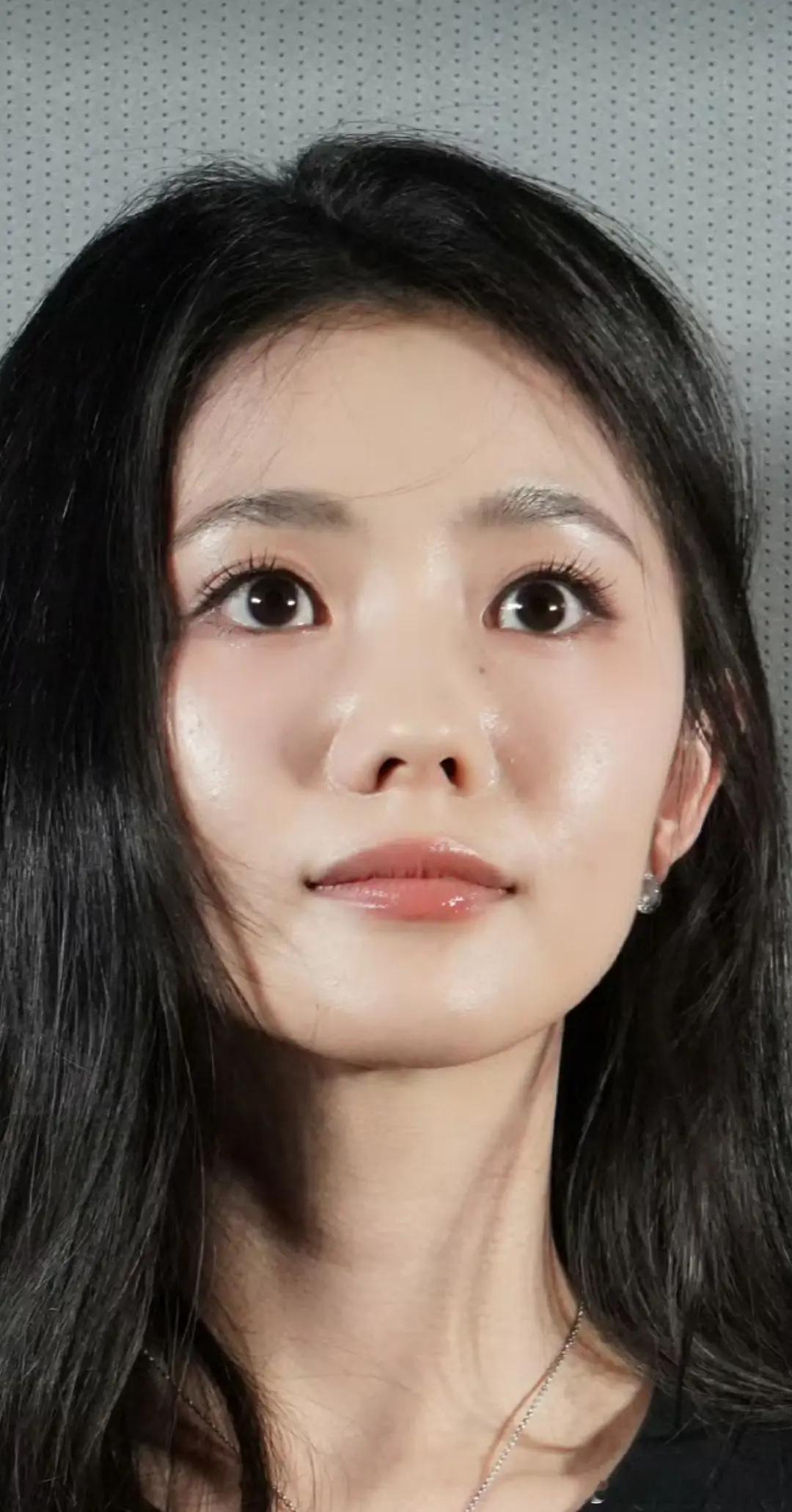 网友热议：刘浩存这是鼻基底凹陷吗？