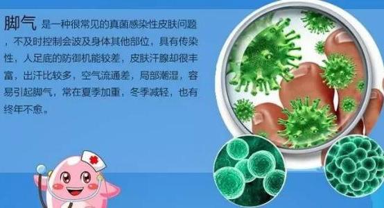 脚气怎么有效彻底的根治 治疗脚气的偏方