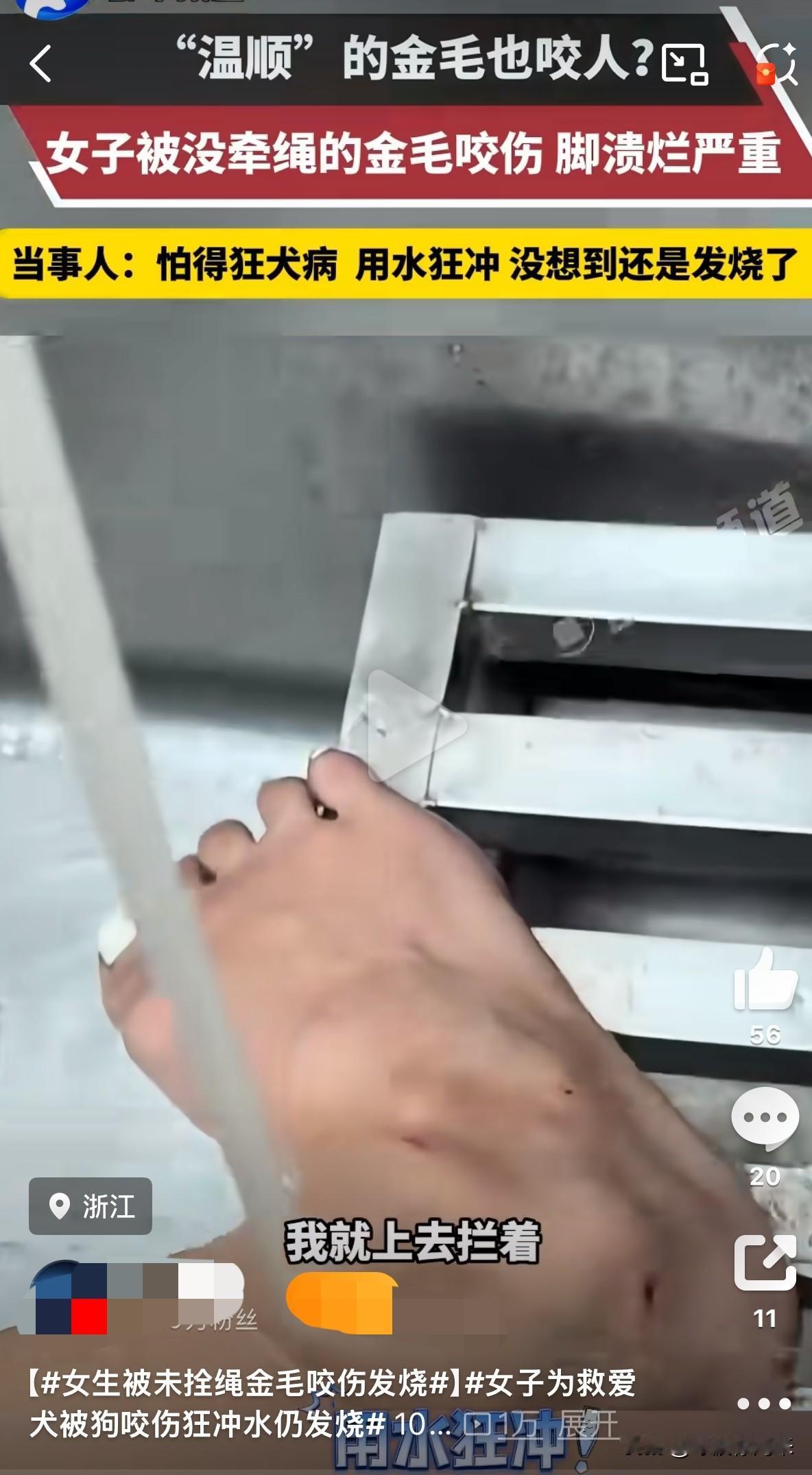 按规定拴绳养狗的人遭了殃，不栓绳的狗倒咬人了！近日，浙江的李女士遭遇了“飞来