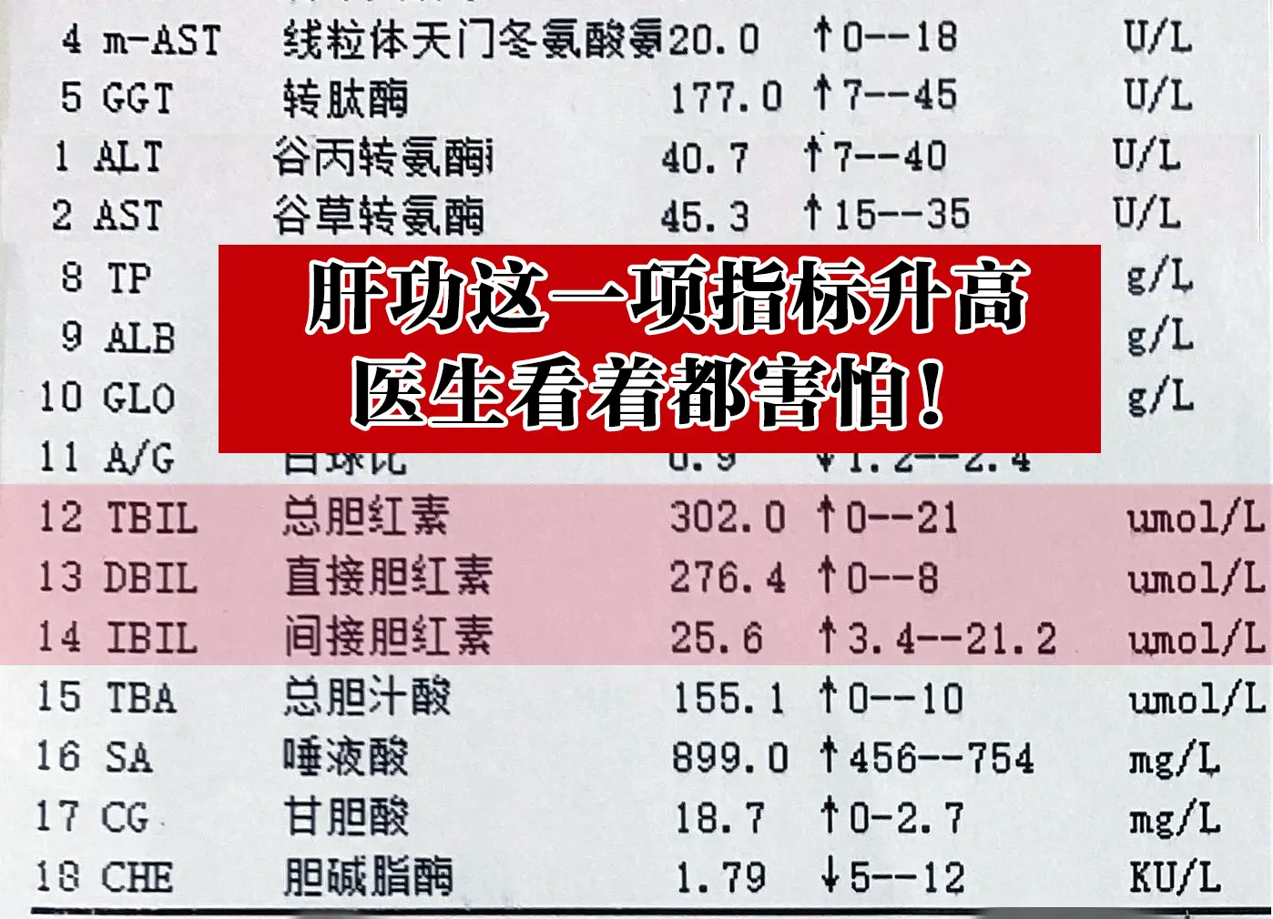 “小伙子，你这还有乙肝，肝功能这一项指标明显升高，医生看着都害怕啊！”...