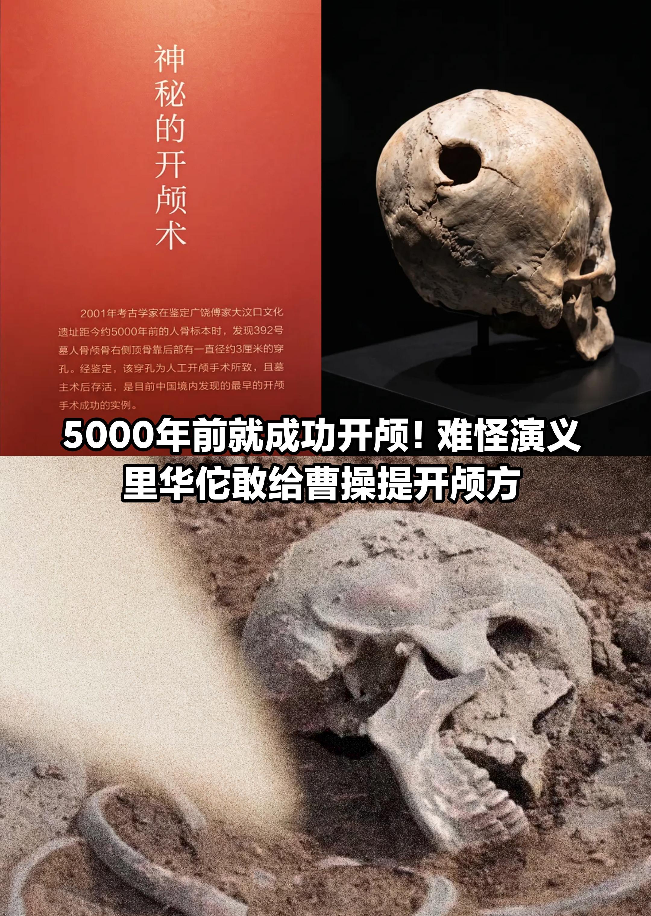 开颅术，5000年前竟已有先例。       很多人以为，开颅手术只是...