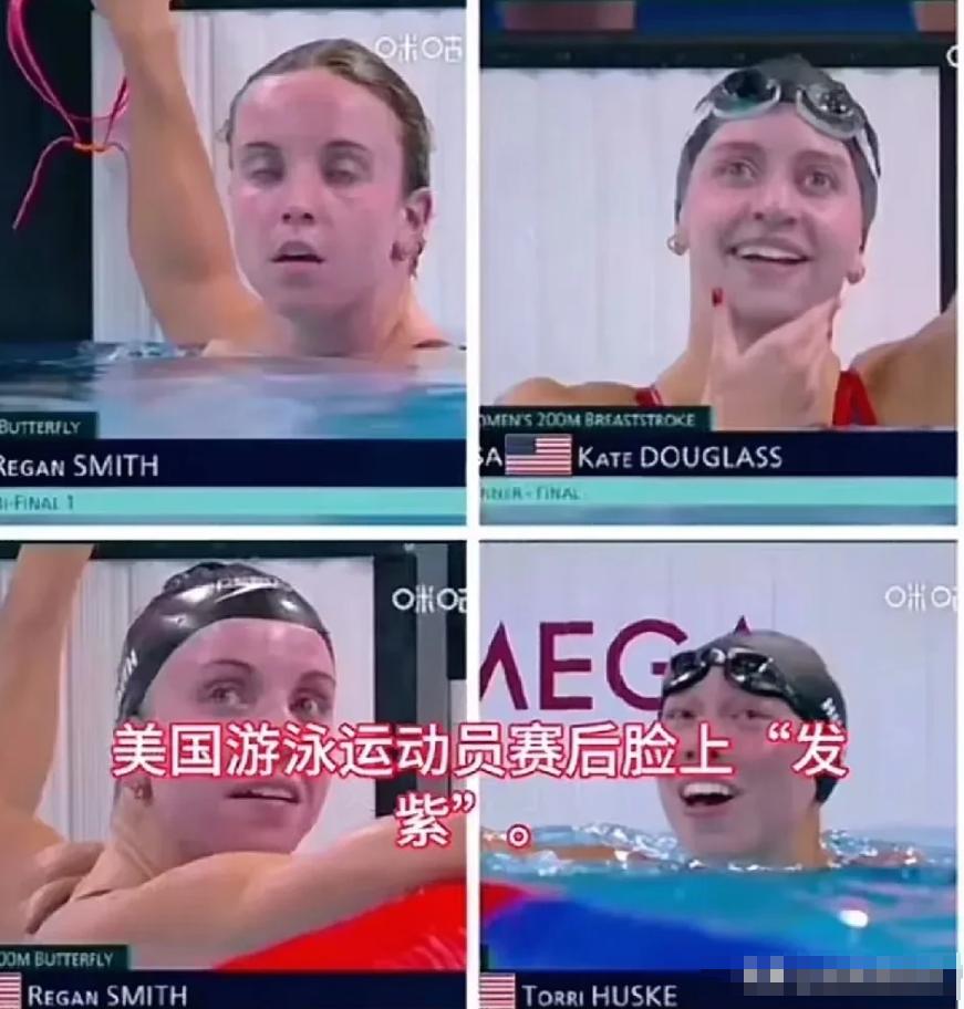 美国游泳队宣称集体食物中毒，然后申请新加坡游泳世锦赛集体医疗豁免。看样子是磕药的