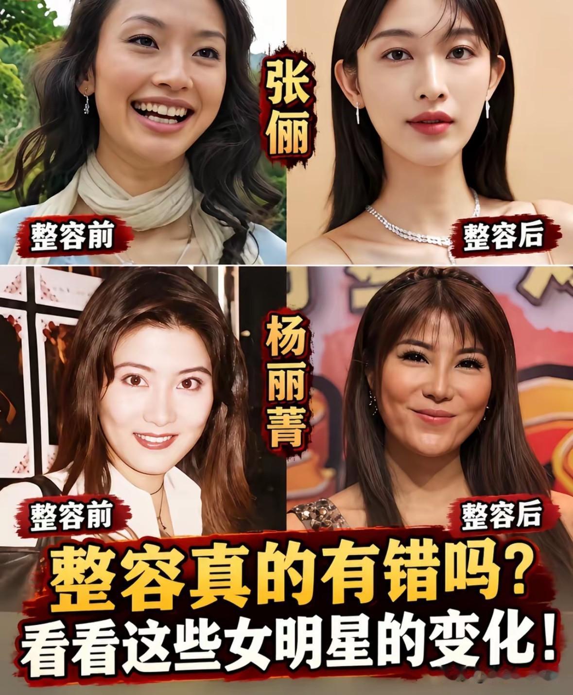 一味批判整容10位女星今昔对比揭开容貌焦虑的真相娱乐圈向来对外貌格外苛刻
