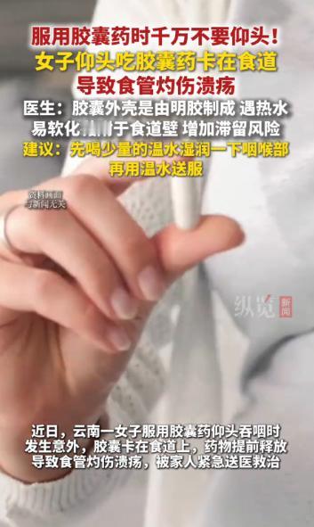 悲剧还是发生了！近日，云南，一女子生病吃胶囊，仰头吞咽时，胶囊却卡在了食道内，本