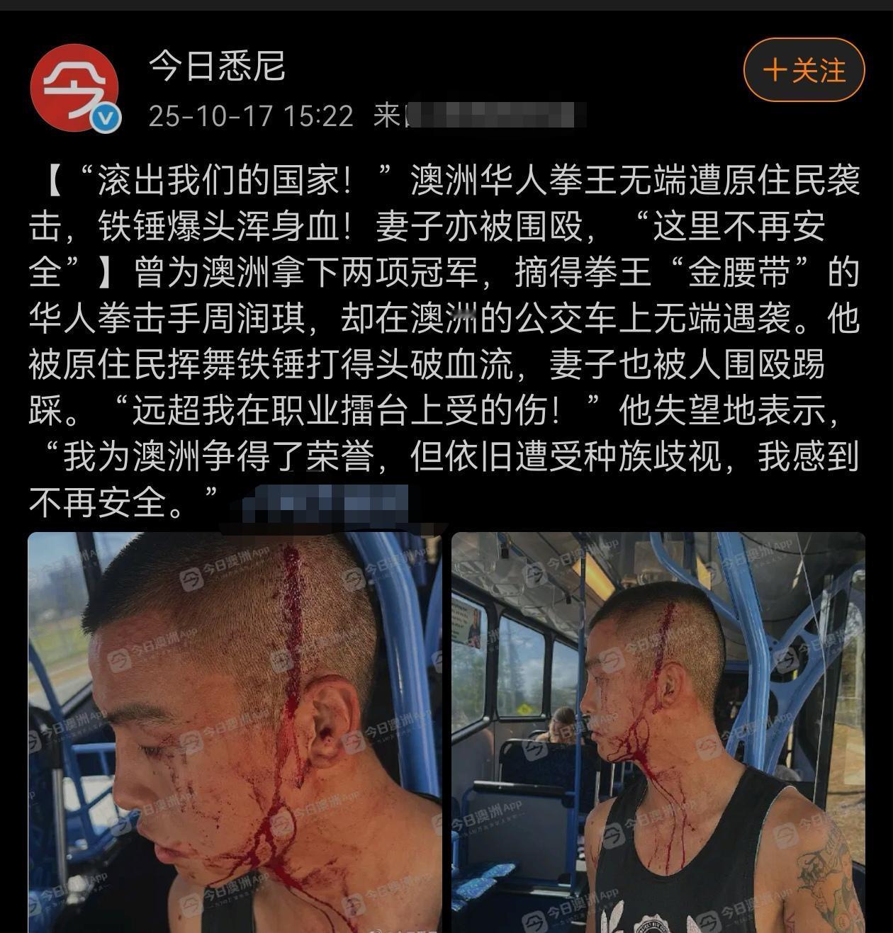 我为澳洲挣得了荣誉，但依旧遭受种族歧视！