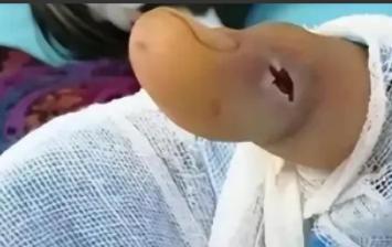 湖北的一个男子常年以捕蛇为生，一辈子杀蛇无数，意外去世之后，他的墓穴里，竟出现了