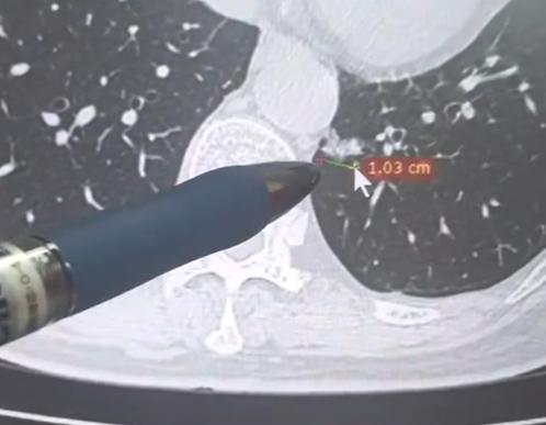 忙完一整天门诊，心里总有些感触想跟大家说说！门诊遇到一对夫妻，拿着术后病理报告来