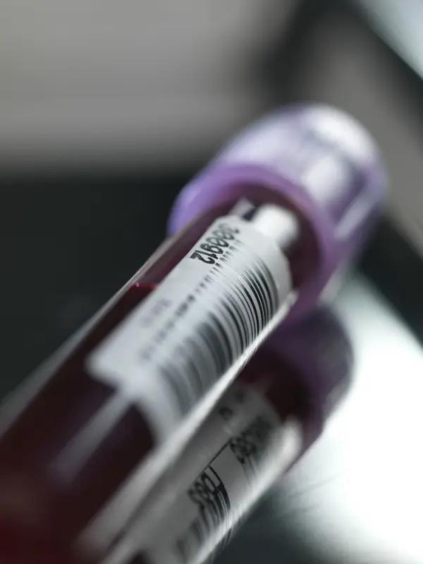 惊人真相：全球70%商业血浆，竟是美国穷人用健康换来的一个颠覆认知的残酷事实：