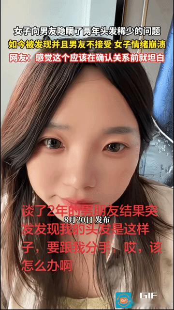 “这是欺骗！”女子和男友隐瞒了头发稀少的问题，两人谈了2年多，感情一直很好。结果