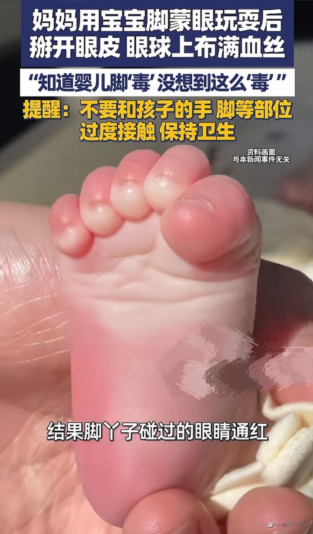 现在终于理解了老人那句“小孩的手脚不要乱亲”，抱小孩前要洗手，原来不是怕我们把细