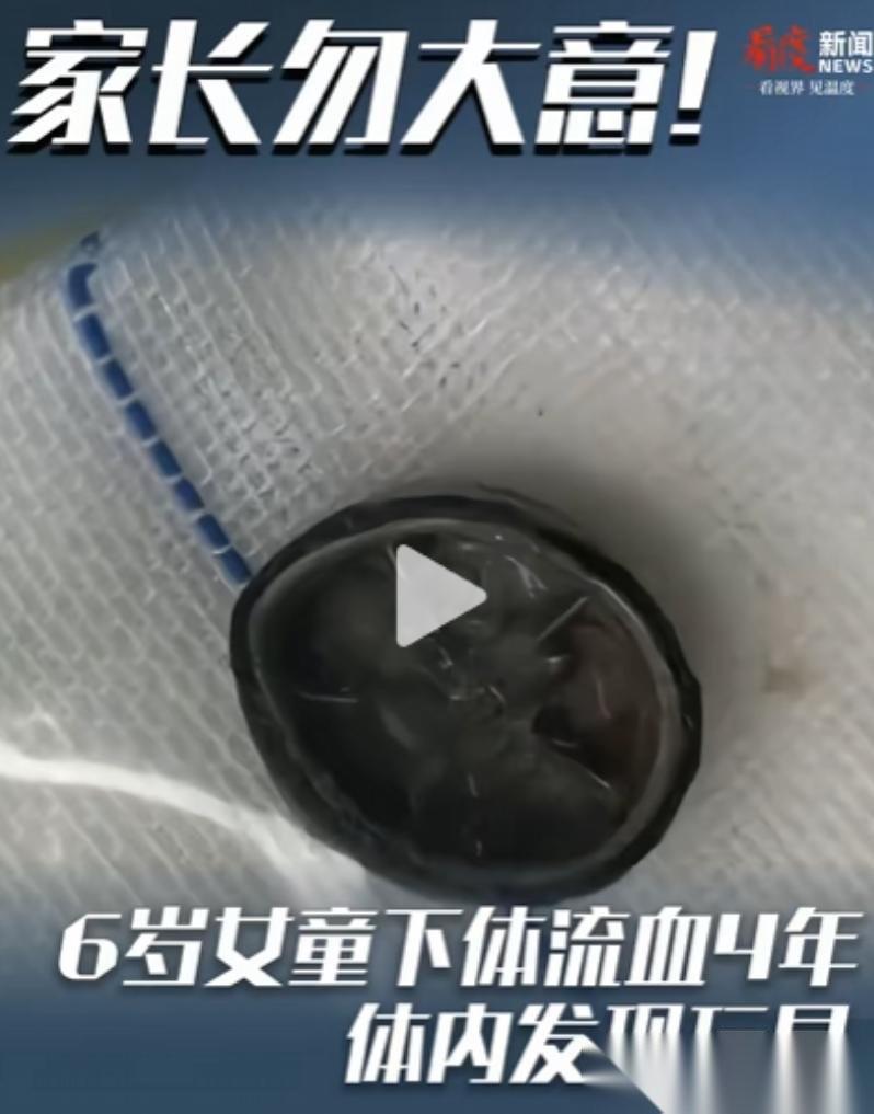 河南郑州，6岁女孩下体一直流血，反反复复在各家医院来回四年，却一直查不出原因。直