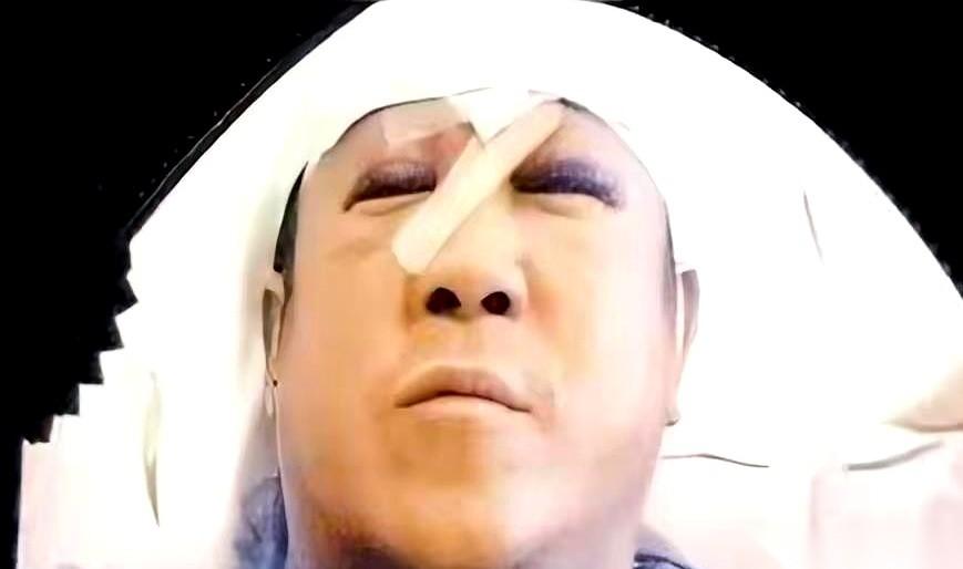缝了29针啊！悬赏一百万去抓凶手，结果查到一半，平时那些称兄道弟的大佬们，突然