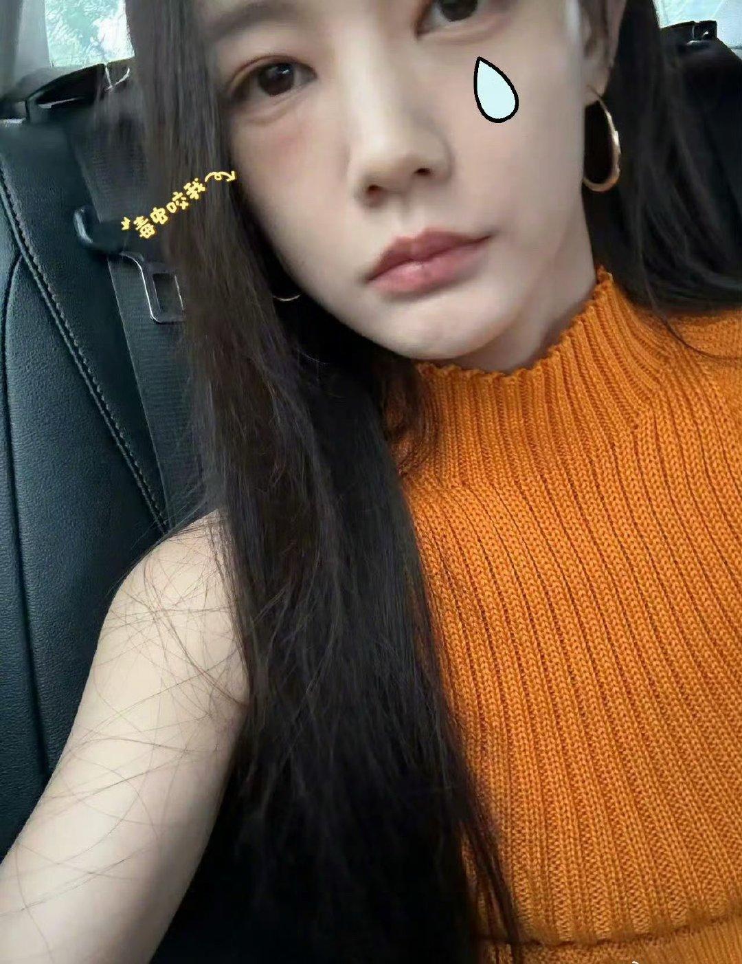 李一桐被毒虫咬了脸李一桐脸被毒虫咬了，脸都肿了！