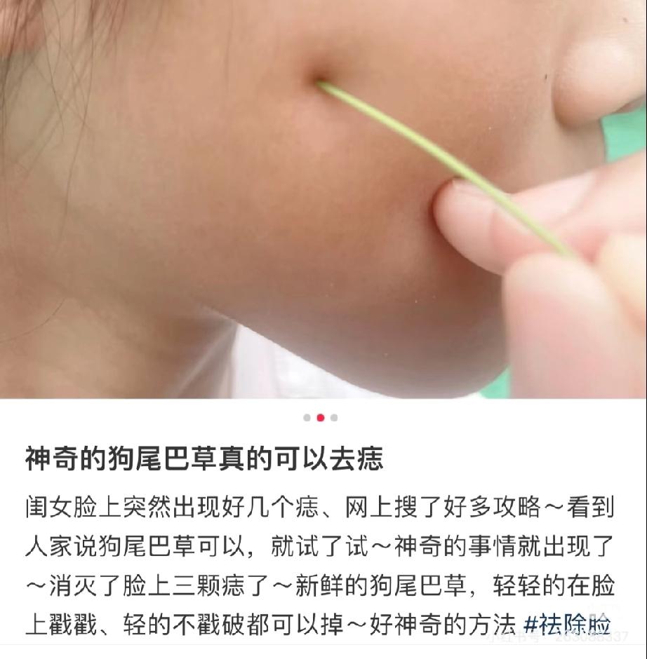 民间偏方，有时候真的不可信！最近下巴上无意间长了一颗黑痣，我想着能不能不花钱